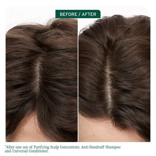 Scalp Sync Anti Dandruff Shampoo - Biolage Renovation NZ | L'Or&eacute;al Partner Shop